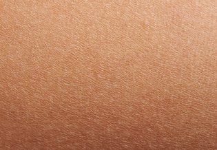 Larocheposay ArticlePage Eczema Dry skin vs eczema
